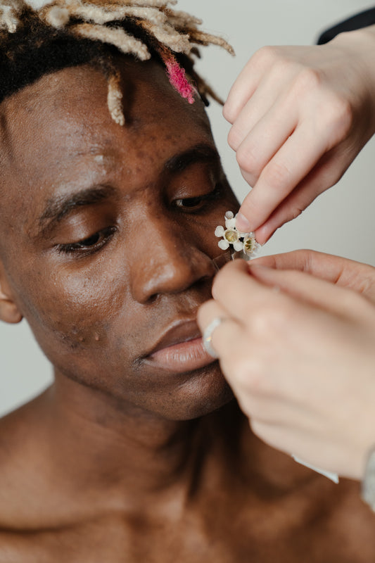 Comment atténuer les taches d'hyperpigmentation sur la peau noire?